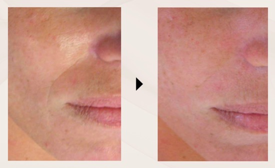 LDMビフォーアフター